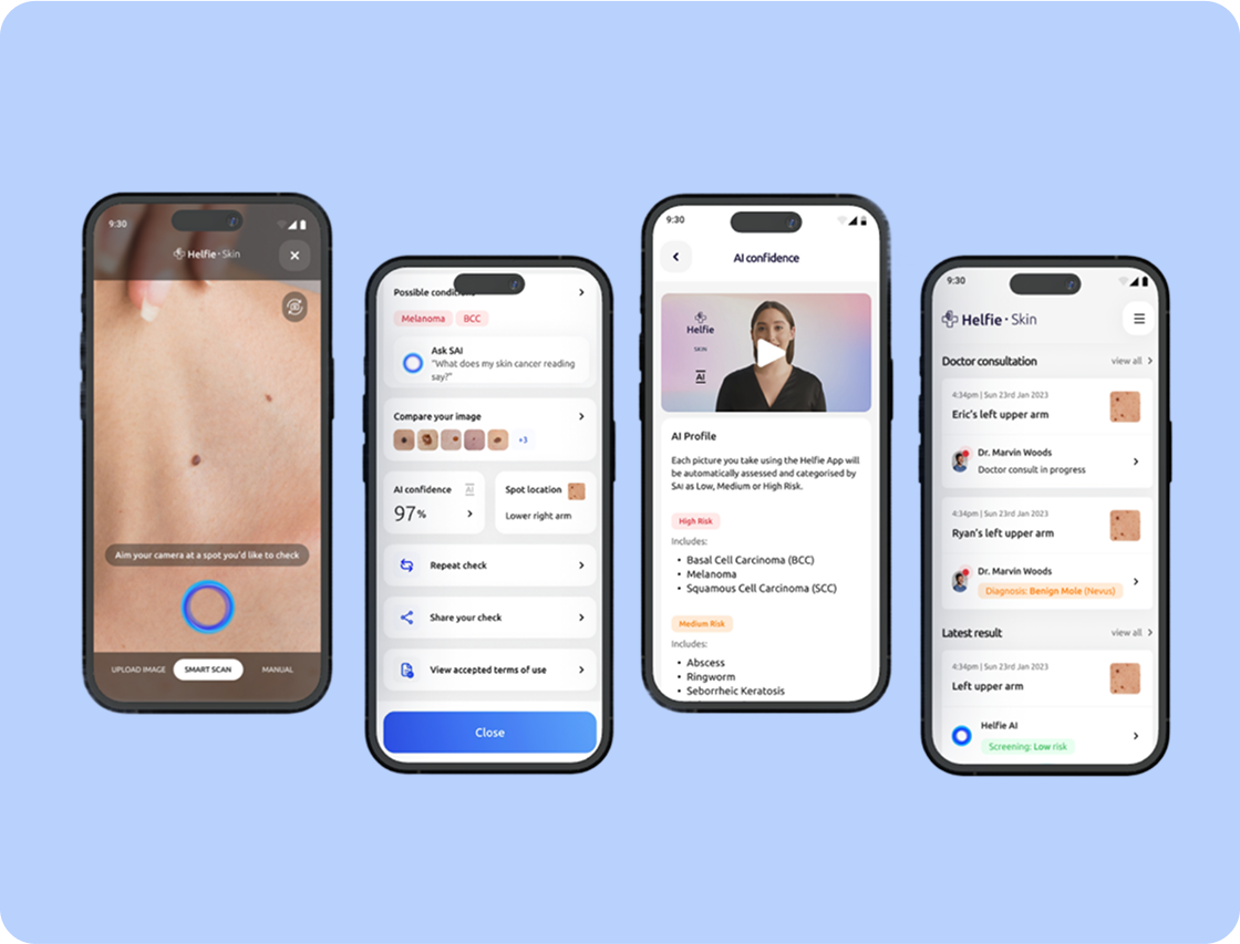 HelfieCase Study